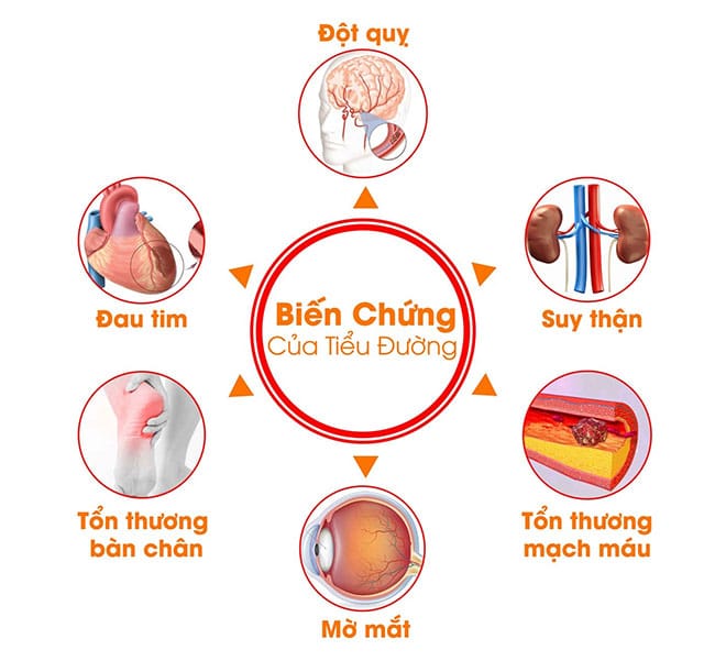 Kiểm soát HbA1c ngăn biến chứng đái tháo đường