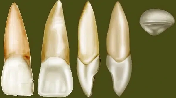 Răng cửa: Vùng răng quyết định thẩm mỹ Rang-cua-giua-ham-tren.jpg