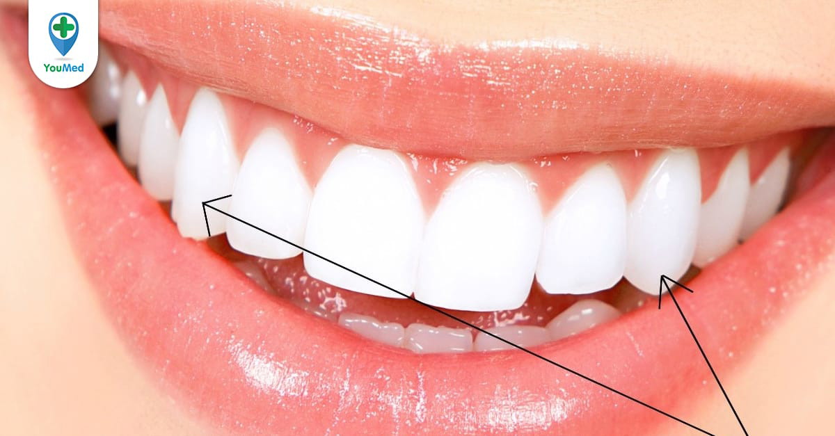 Răng nanh dưới xuất hiện trong khoảng tuổi nào?
