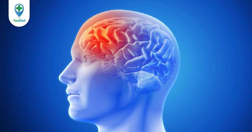 Rối loạn chức năng não sau hóa trị: Dấu hiệu, Nguyên nhân, Chẩn đoán và Điều trị