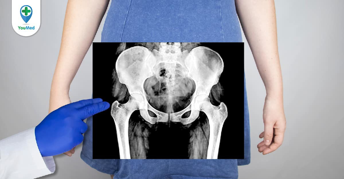 Nếu có xương chậu hẹp, liệu có điều chỉnh nào để giúp mở rộng xương chậu?

