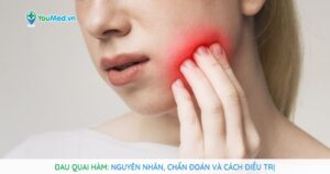 Đau quai hàm: Nguyên nhân, chẩn đoán và cách điều trị