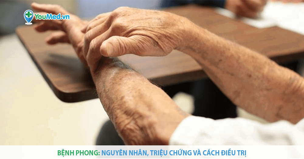 Người bị phong cùi nên có chế độ dinh dưỡng và sinh hoạt như thế nào?
