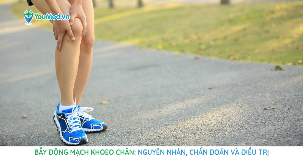 Bẫy động mạch khoeo chân: Nguyên nhân, chẩn đoán và điều trị