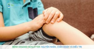 Bệnh Osgood-Schlatter (viêm lồi củ trước xương chày): Nguyên nhân, triệu chứng và điều trị