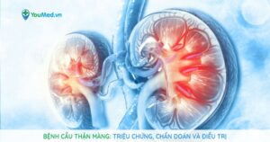 Bệnh cầu thận màng: Triệu chứng, chẩn đoán và điều trị