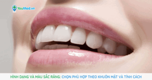 Chọn hình dạng và màu sắc răng phù hợp