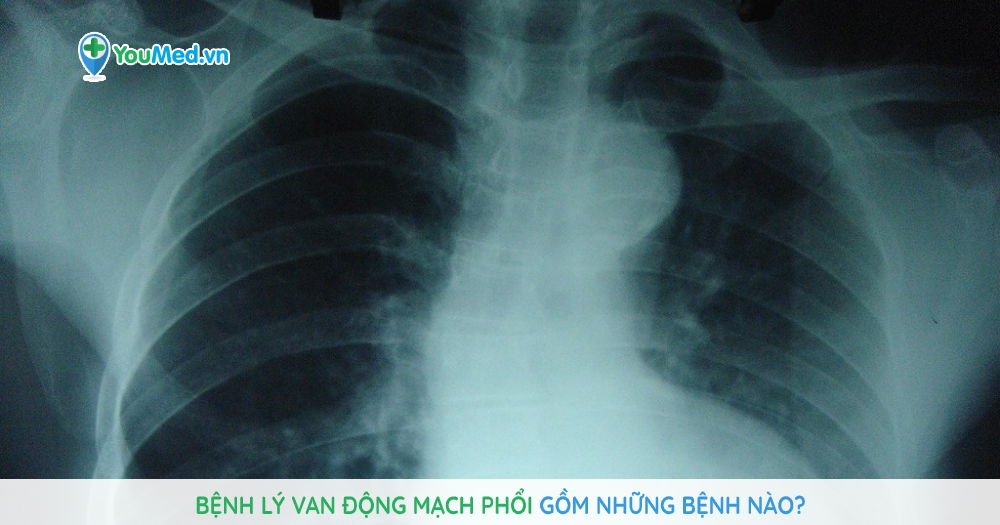 Bệnh lý van động mạch phổi gồm những bệnh nào?