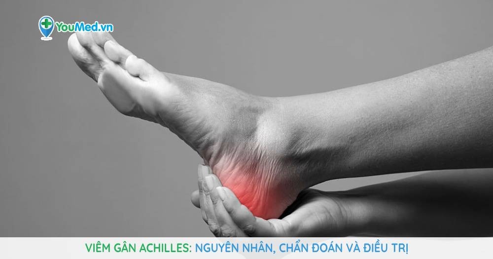 Viêm gân Achilles: nguyên nhân, chẩn đoán và điều trị