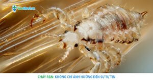 Chấy rận và những nguy cơ tiềm ẩn với sức khỏe
