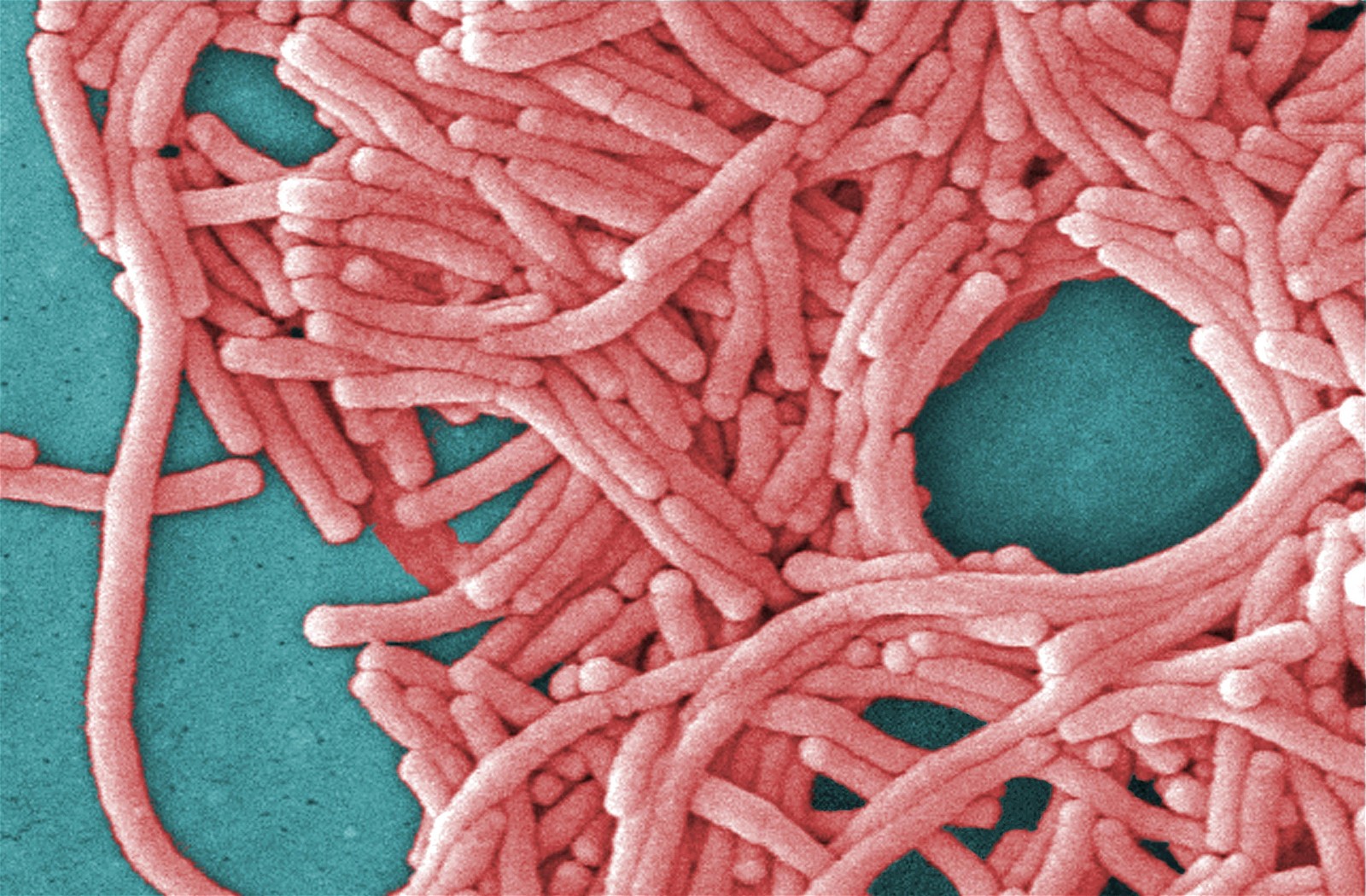 Legionnaires là tình trạng viêm phổi nghiêm trọng do virus Legionella gây ra