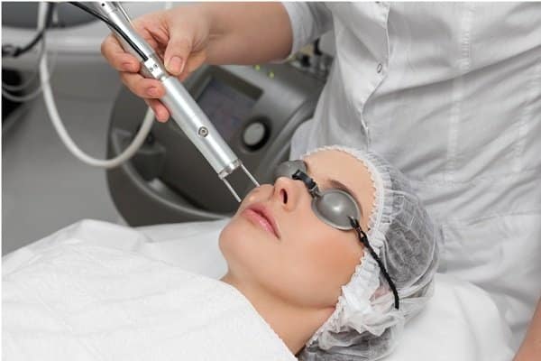 Phương pháp Laser trị nếp nhăn