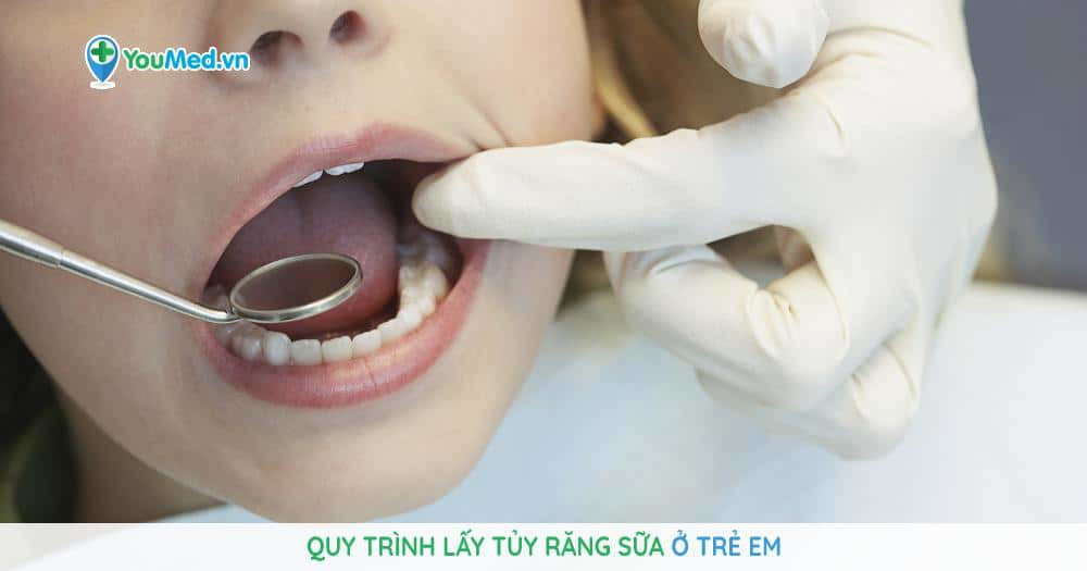 Bước đầu tiên trong quy trình điều trị tủy răng sữa là gì?
