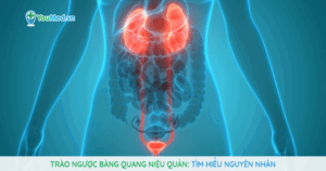 Trào ngược bàng quang niệu quản: Nguyên nhân, nguy cơ và biến chứng