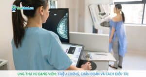 Ung thư vú dạng viêm: Kiến thức và thái độ