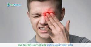 Ung thư biểu mô tuyến bã: Khối u mi mắt chết người