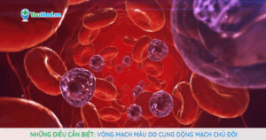 Vòng mạch máu do cung động mạch chủ đôi là gì?