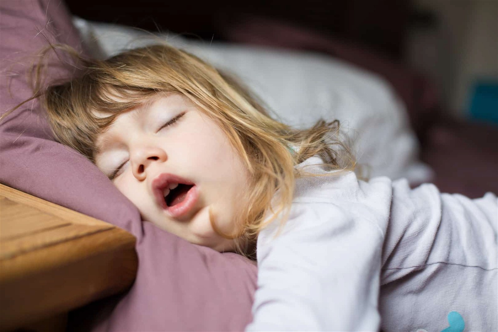 Trẻ thở bằng miệng khi ngủ là một trong những triệu chứng điển hình của bệnh ngưng thở khi ngủ