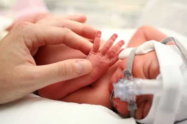 Biến chứng nặng nề nhất của hội chứng hít phân su là suy hô hấp ở trẻ sơ sinh.