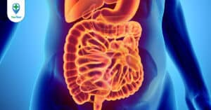 Viêm manh tràng: Nguyên nhân, triệu chứng và cách điều trị