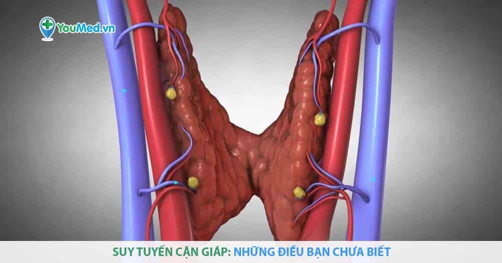 Suy tuyến cận giáp: Những điều bạn chưa biết