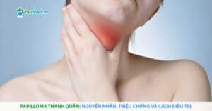 Papilloma thanh quản: Nguyên nhân, triệu chứng và cách điều trị