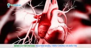 Bệnh cơ tim phì đại: nguyên nhân, triệu chứng và điều trị