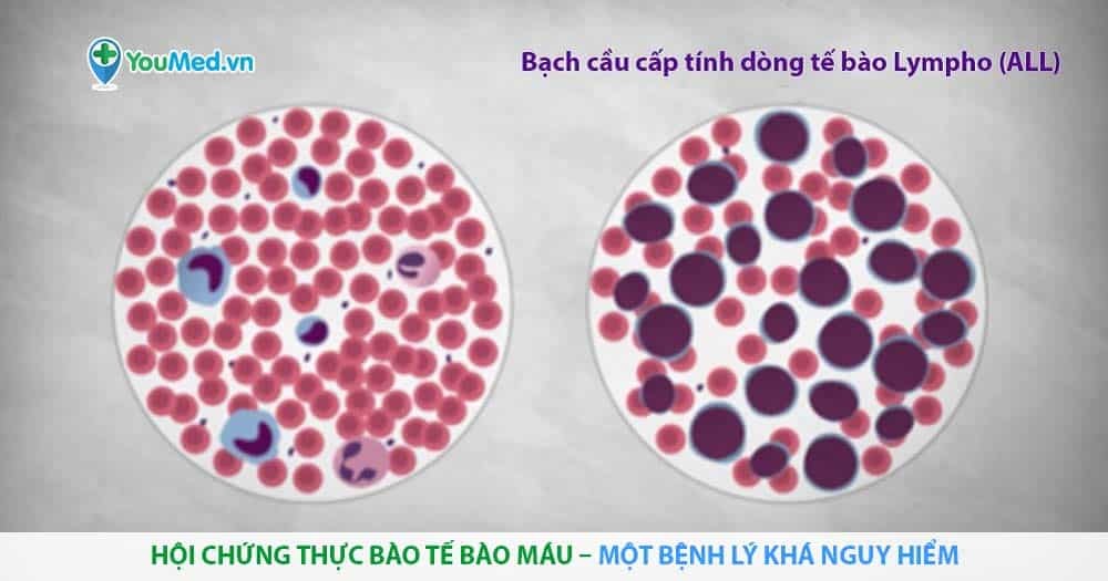 Hội chứng thực bào tế bào máu