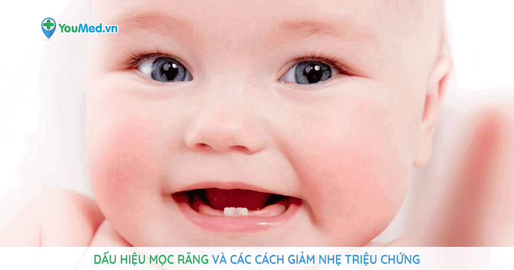 Dấu hiệu mọc răng và các cách giảm nhẹ triệu chứng