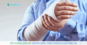 Gãy xương cánh tay: Nguyên nhân, triệu chứng và cách điều trị