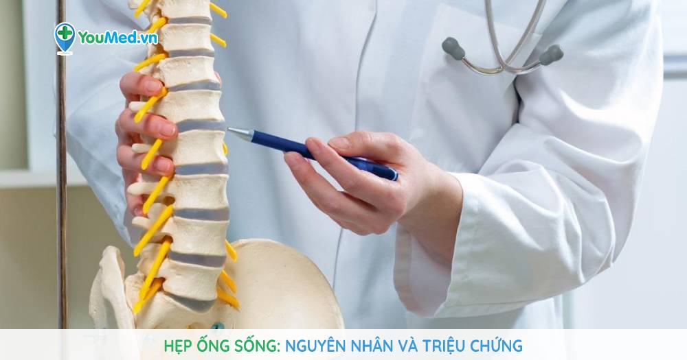 Hẹp ống sống: nguyên nhân và triệu chứng