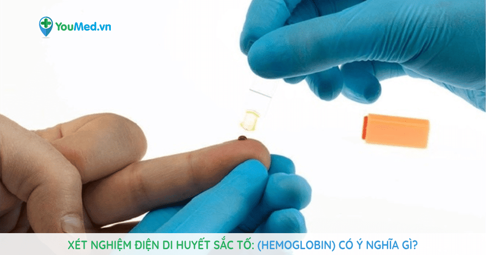 Xét nghiệm điện di huyết sắc tố (hemoglobin) có ý nghĩa gì?