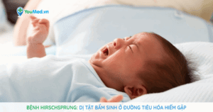 Bệnh Hirschsprung: nguyên nhân, triệu chứng và điều trị