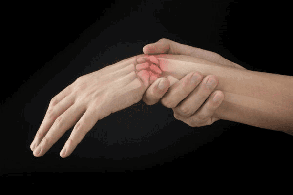 Gãy xương cổ tay: những điều bạn cần biết - YouMed