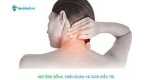 Hẹp ống sống: chẩn đoán và điều trị