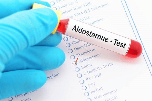  Xét nghiệm nồng độ Aldosterone trong máu