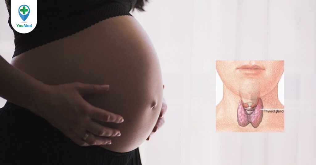 Suy giáp có nên mang thai không?