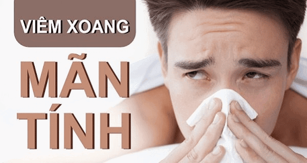 Viêm xoang mạng thường liên quan đến sưng mũi do dị ứng