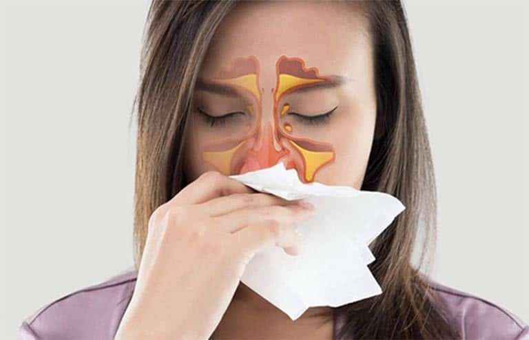 Thuốc xịt mũi Coldi B