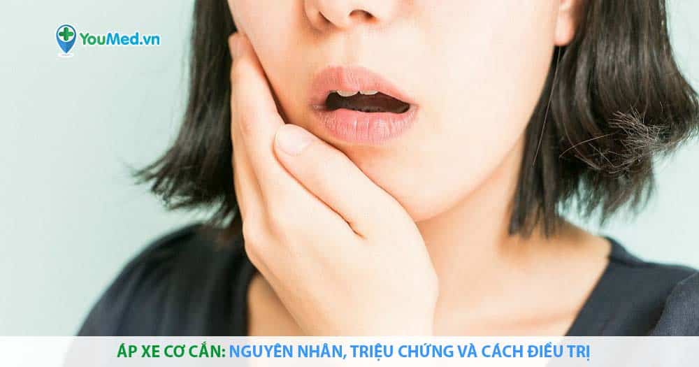 Áp xe cơ cắn: Nguyên nhân, triệu chứng và cách điều trị