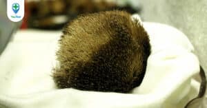 Xạ hương: vị thuốc Đông y chữa hôn mê, đau nhức