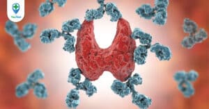 Viêm giáp Hashimoto và những điều bạn cần biết