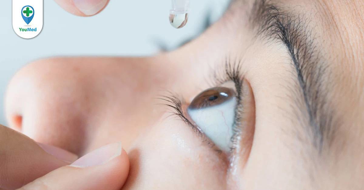 Tại sao thuốc nhỏ mắt Sante FX Nhật Bản được đánh giá là một lựa chọn tốt cho mắt cận?

