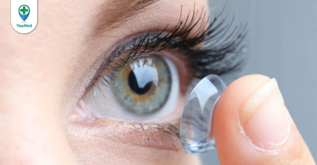 Đeo kính áp tròng dùng thuốc nhỏ mắt nào?