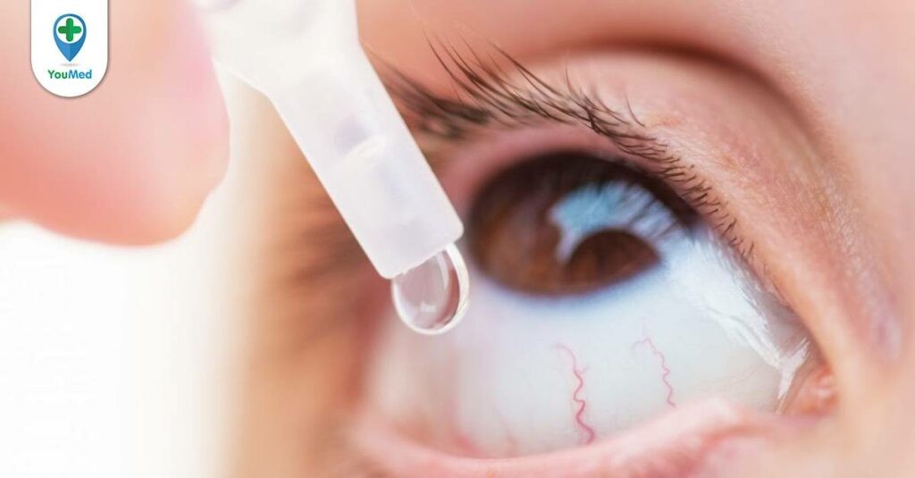 Thuốc nhỏ mắt kháng sinh là gì? Sử dụng như thế nào?