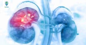 Những triệu chứng ung thư thận mà bạn không thể bỏ qua