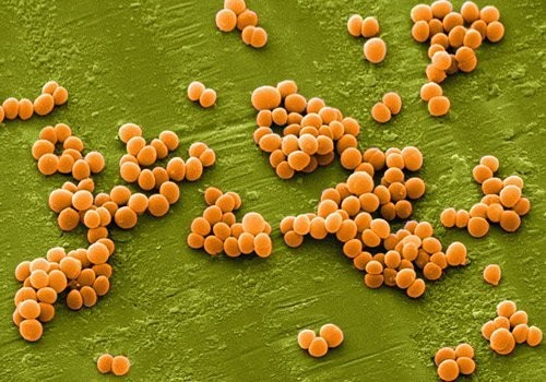 Staphylococus aureus là vi khuẩn gây ngộ độc thực phẩm