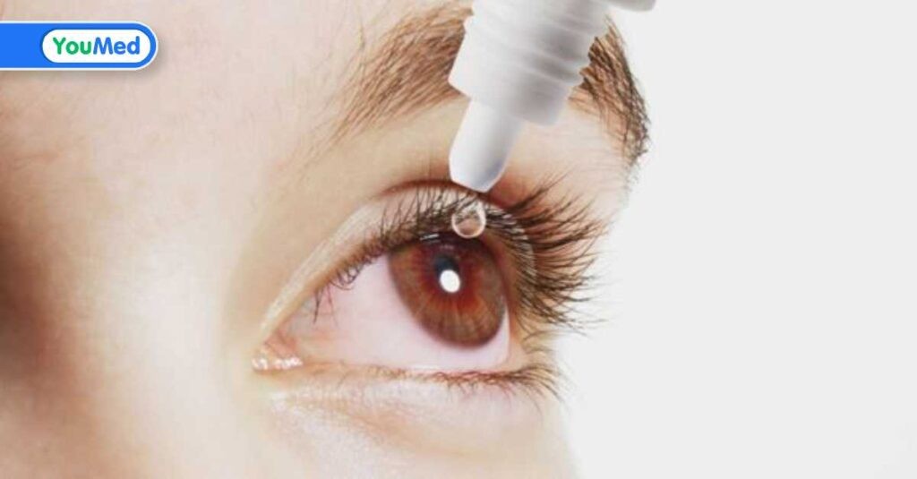 Thuốc nhỏ mắt viêm kết mạc được dùng hiện nay? Lưu ý khi sử dụng