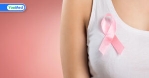 Ung thư vú giai đoạn cuối: xâm lấn hoặc di căn