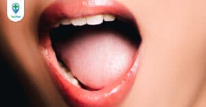 Cách nhận biết Ung thư lưỡi: Những cảnh báo từ chuyên gia